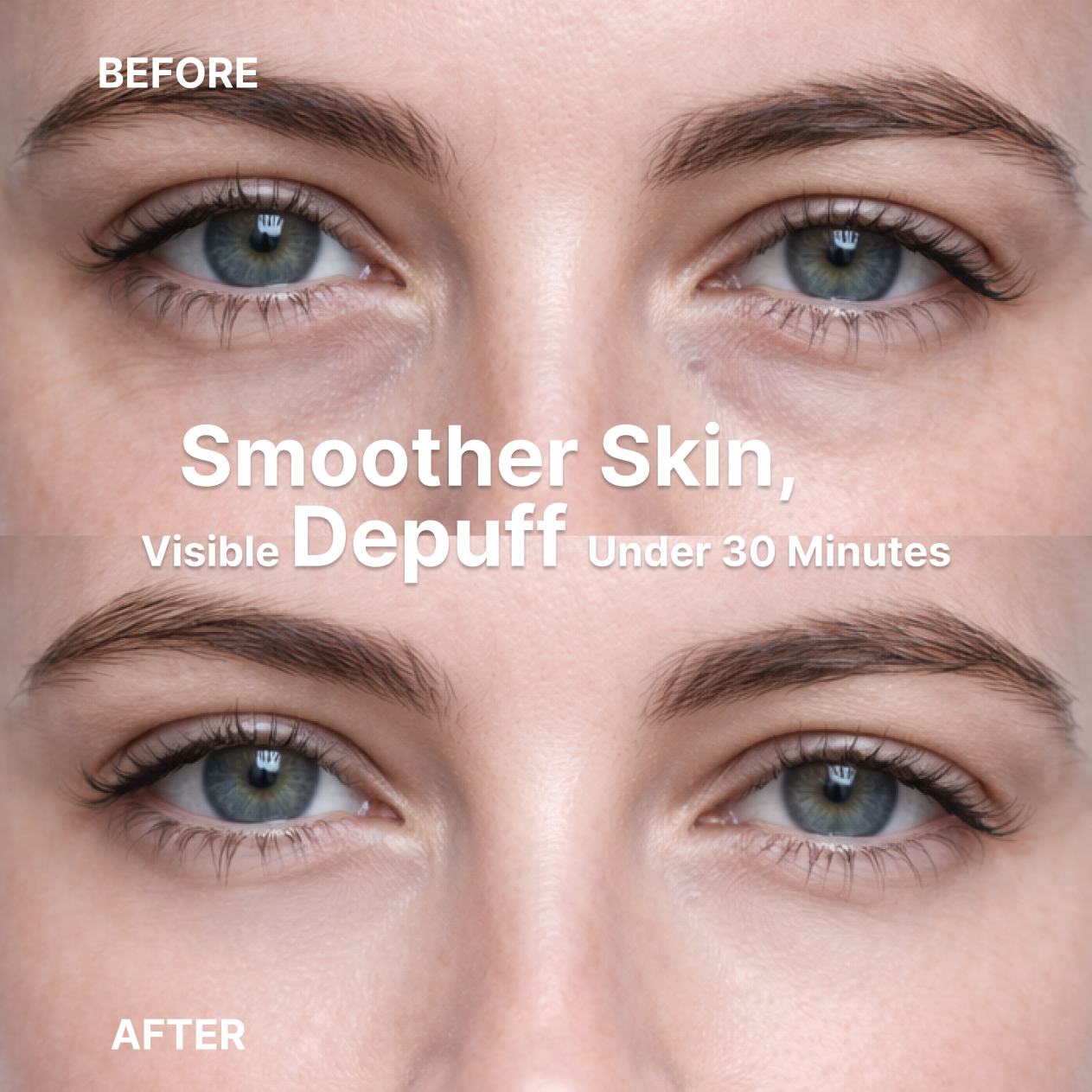 BLUR™ Microneedle Under-Eye Patches